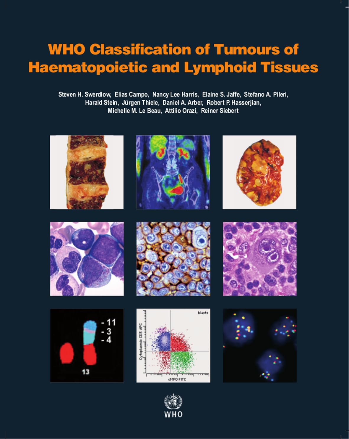 WHO Classification of Tumours of Haematopoietic and Lymphoid Tissues: Vol. 2 (World Health Organization Classification of Tumours, Band 2) Medicine