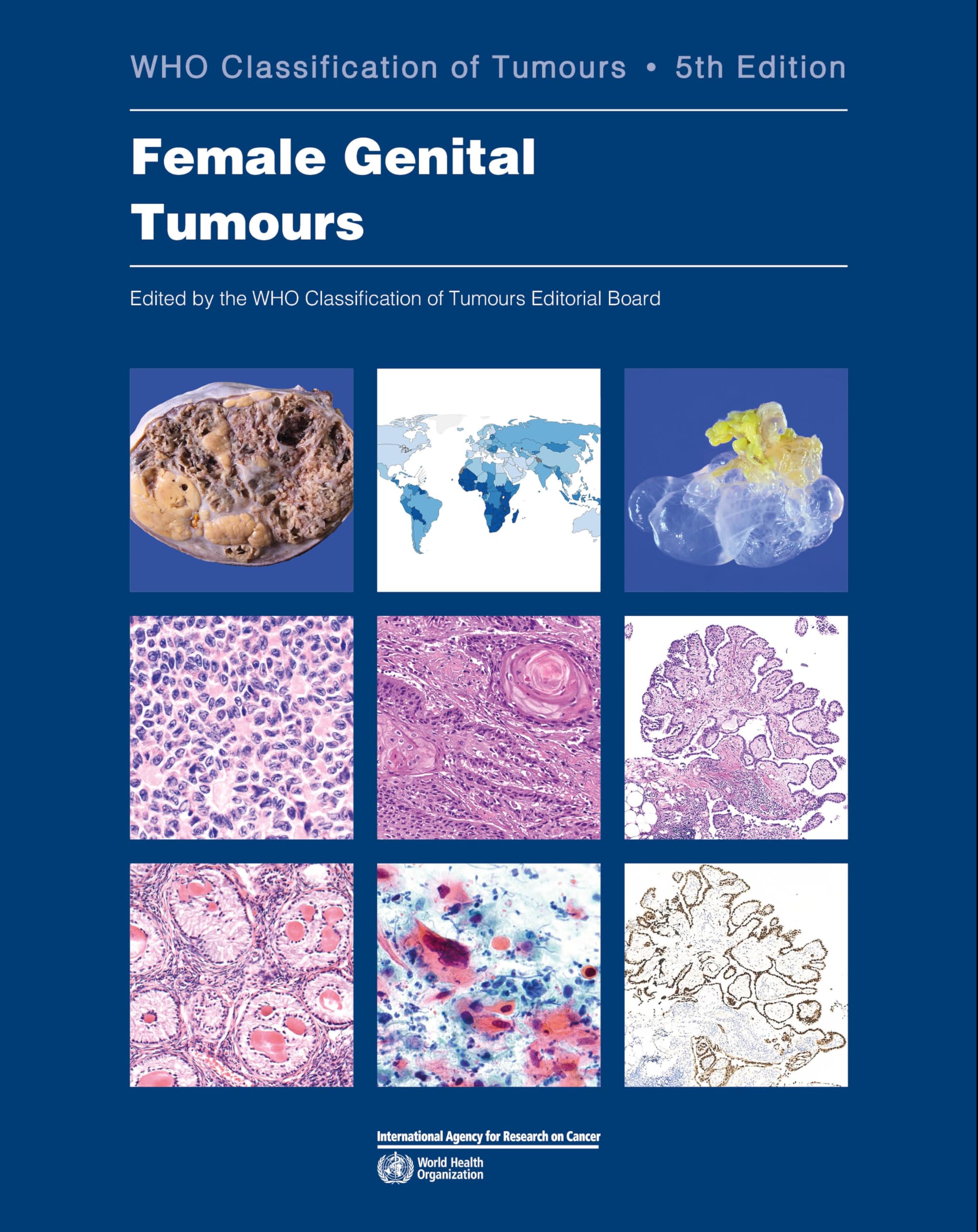 Female Genital Tumours: Who Classification of Tumours (Who Classification of Tumours, 4, Band 4) Medicine