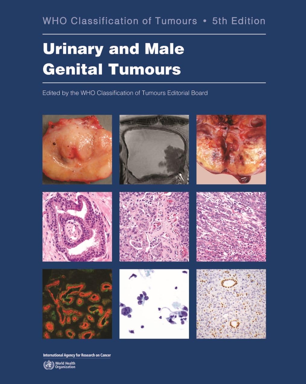 Urinary and Male Genital Tumours (Who Classification of Tumours) Medicine