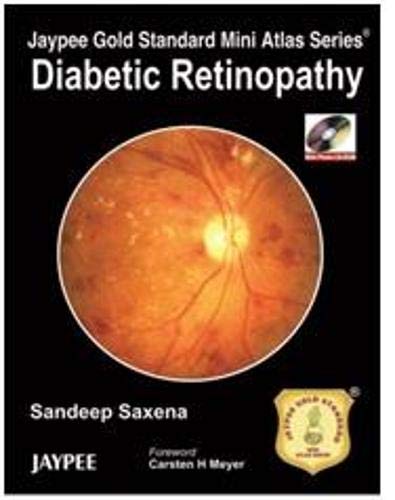 Jaypee Gold Standard Mini Atlas Series: Diabetic Retinopathy Medicine
