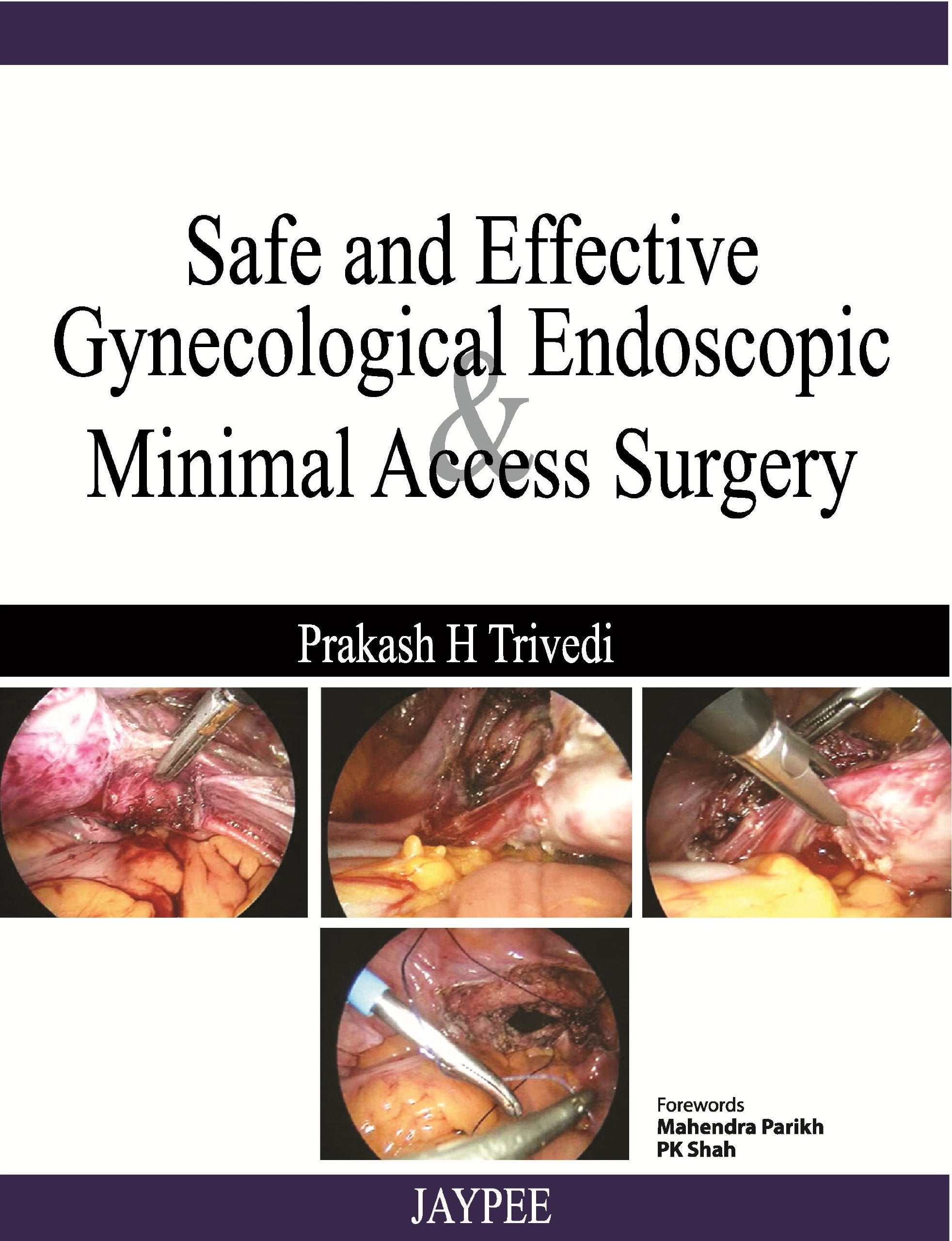 Safe and Effective Gynecological Endoscopic and Minimal Access Surgery Medicine
