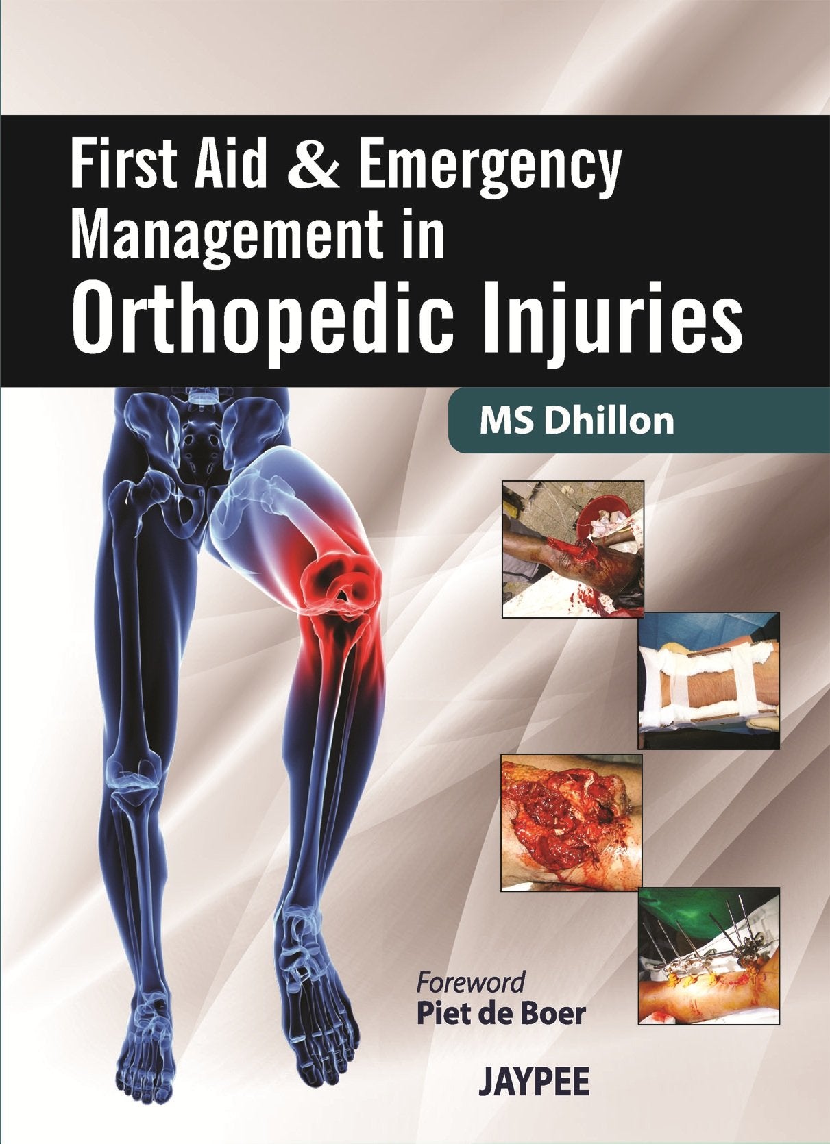 First Aid and Emergency Management in Orthopedic Injuries Medicine