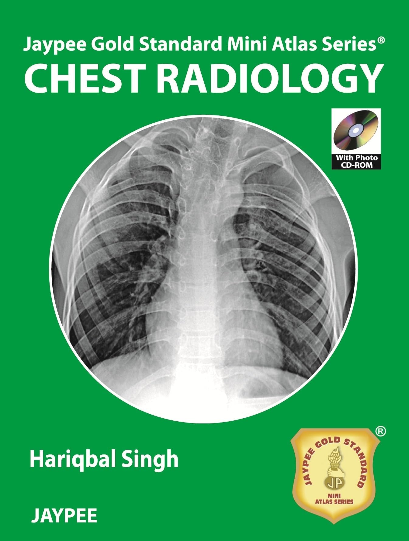 Chest Radiology (Jaypee Gold Standard Mini Atlas) Medicine