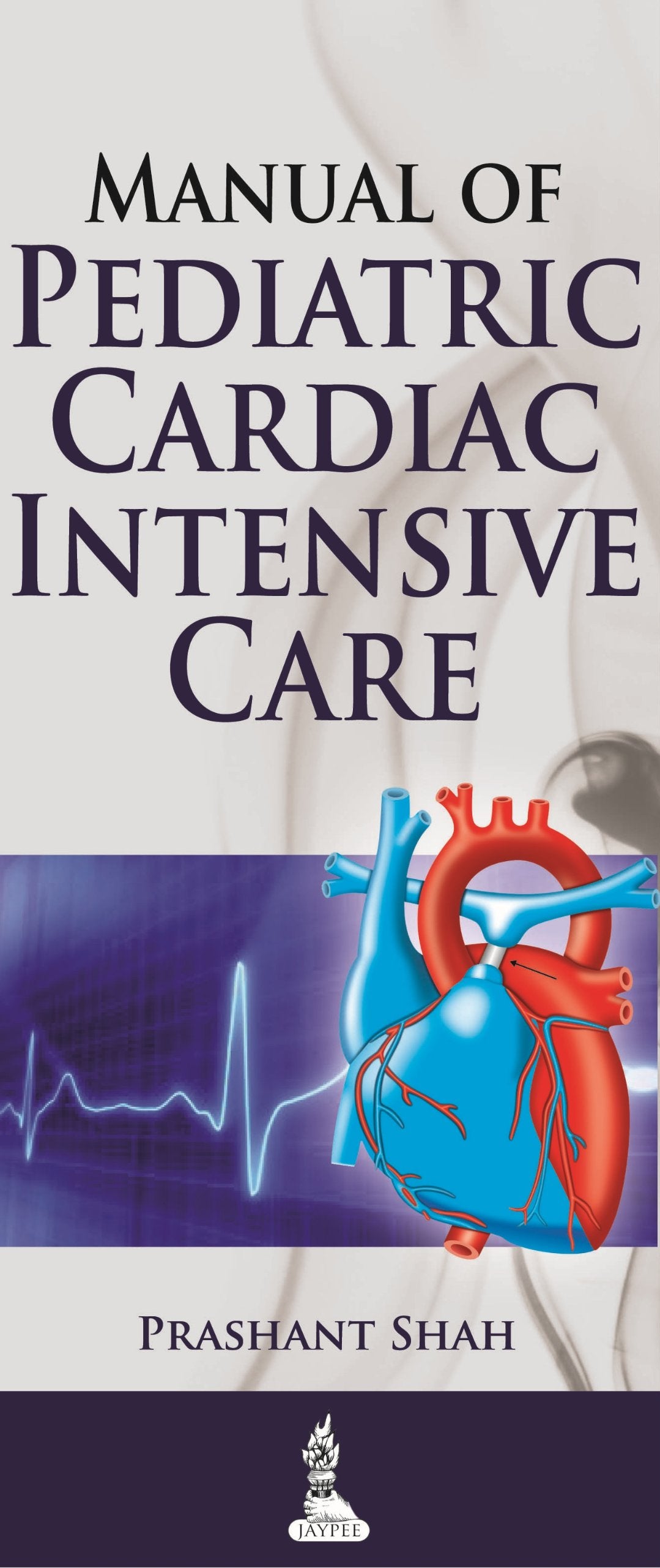 Manual of Pediatric Cardiac Intensive Care book