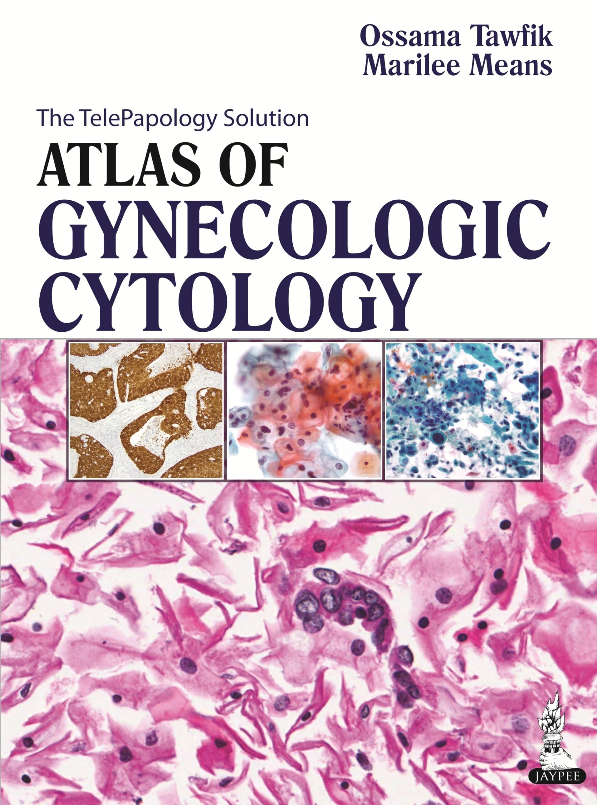 Atlas of Gynecologic Cytology Medicine