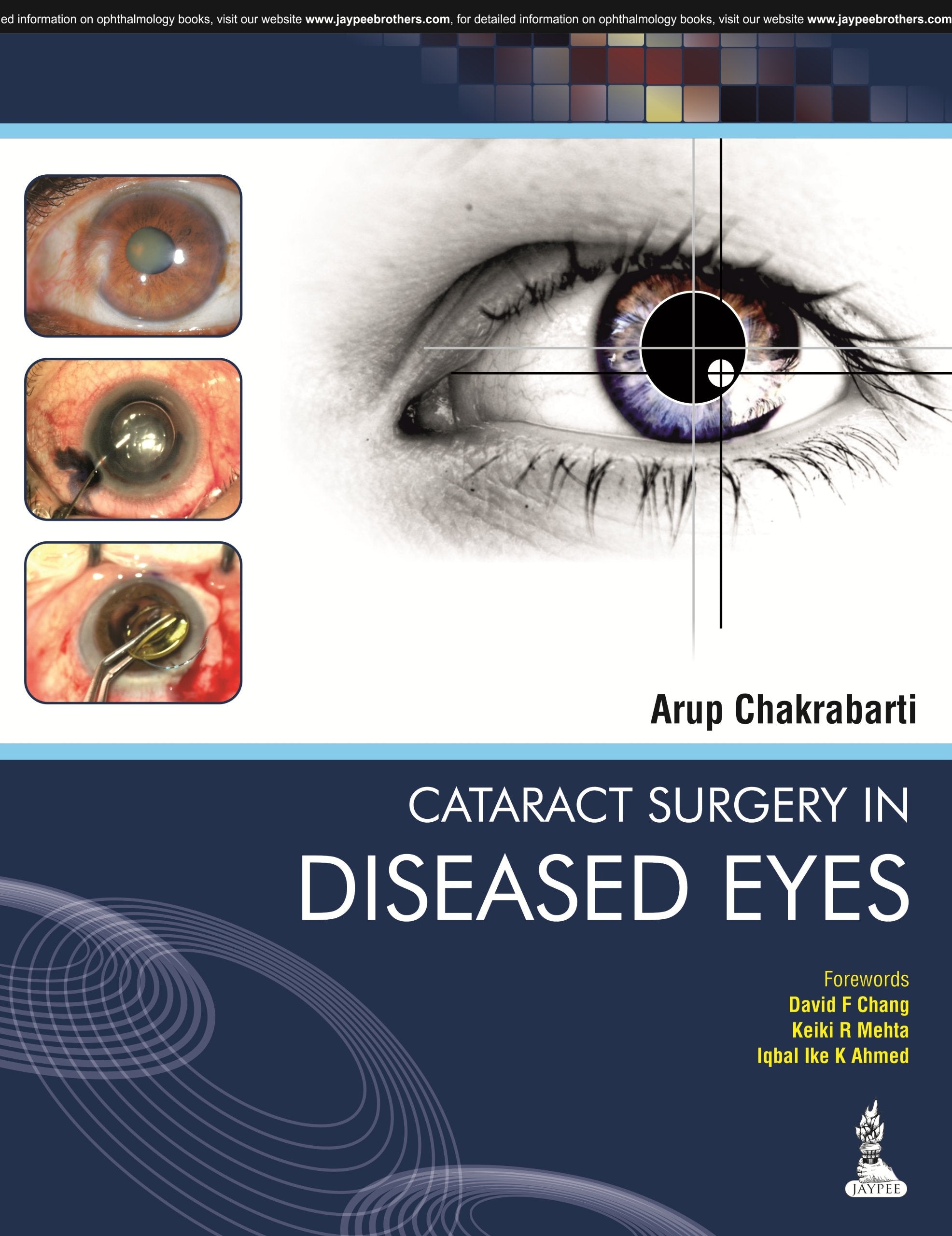 Cataract Surgery in Diseased Eyes Medicine