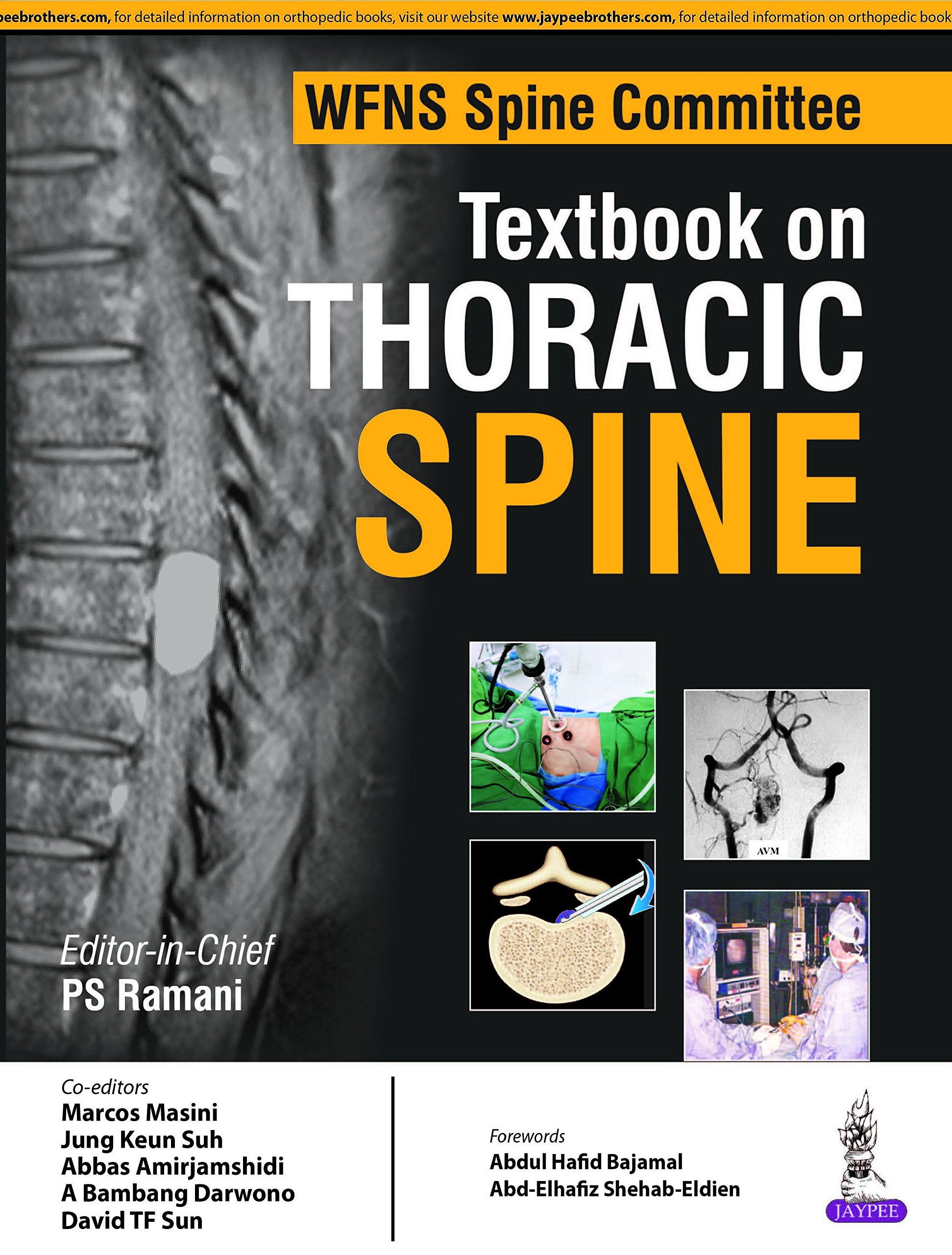 WFNS Spine Committee Textbook on Thoracic Spine Medicine