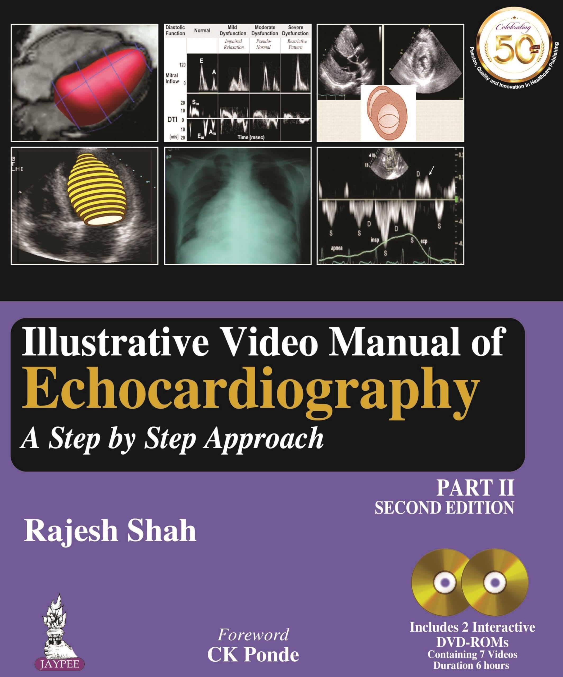 Illustrative Video Manual of Echocardiography: A Step by Step Approach: A Step by Step Approach - Part 2 Medicine