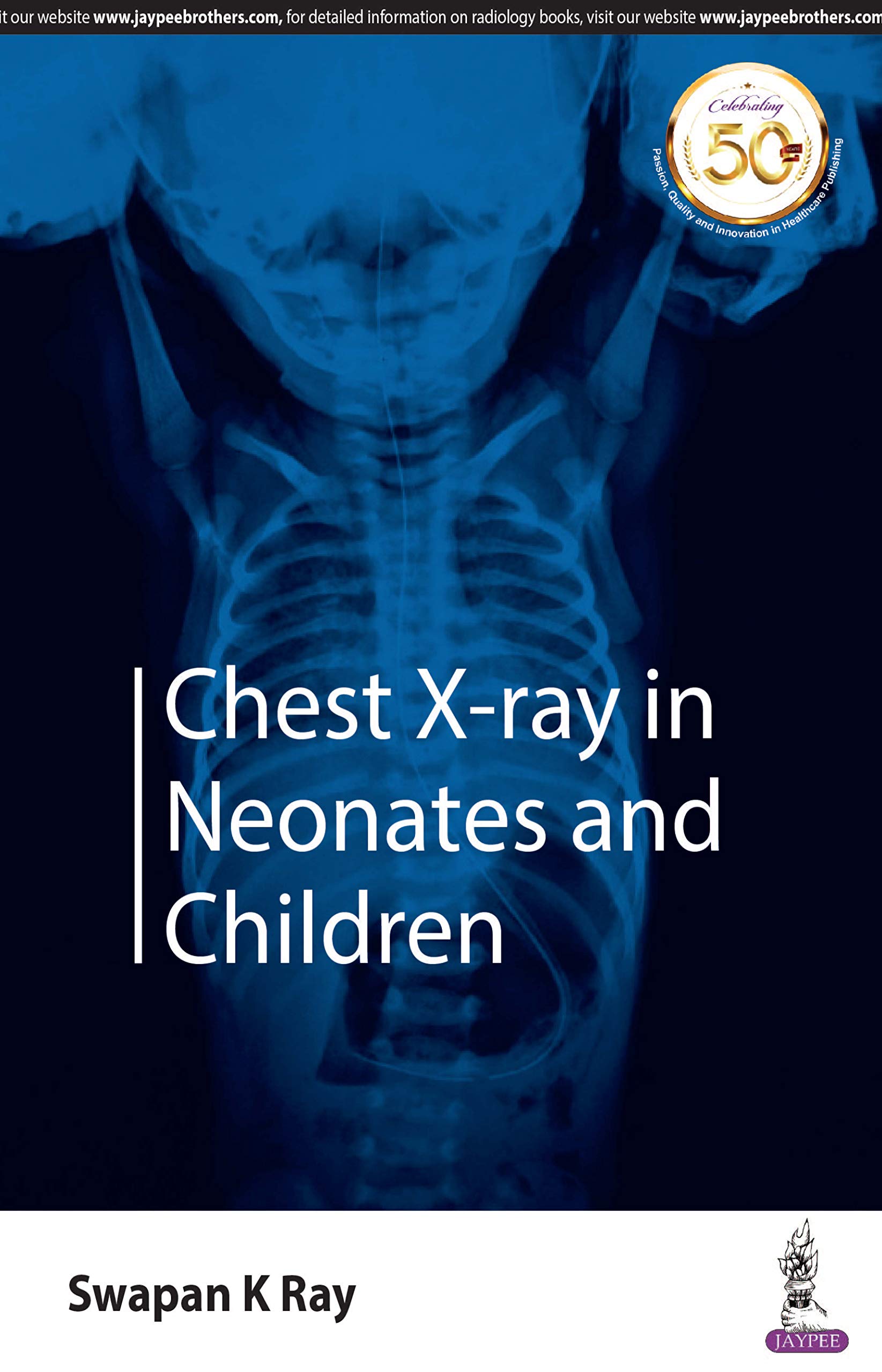 Chest X-Ray in Neonates and Children Medicine