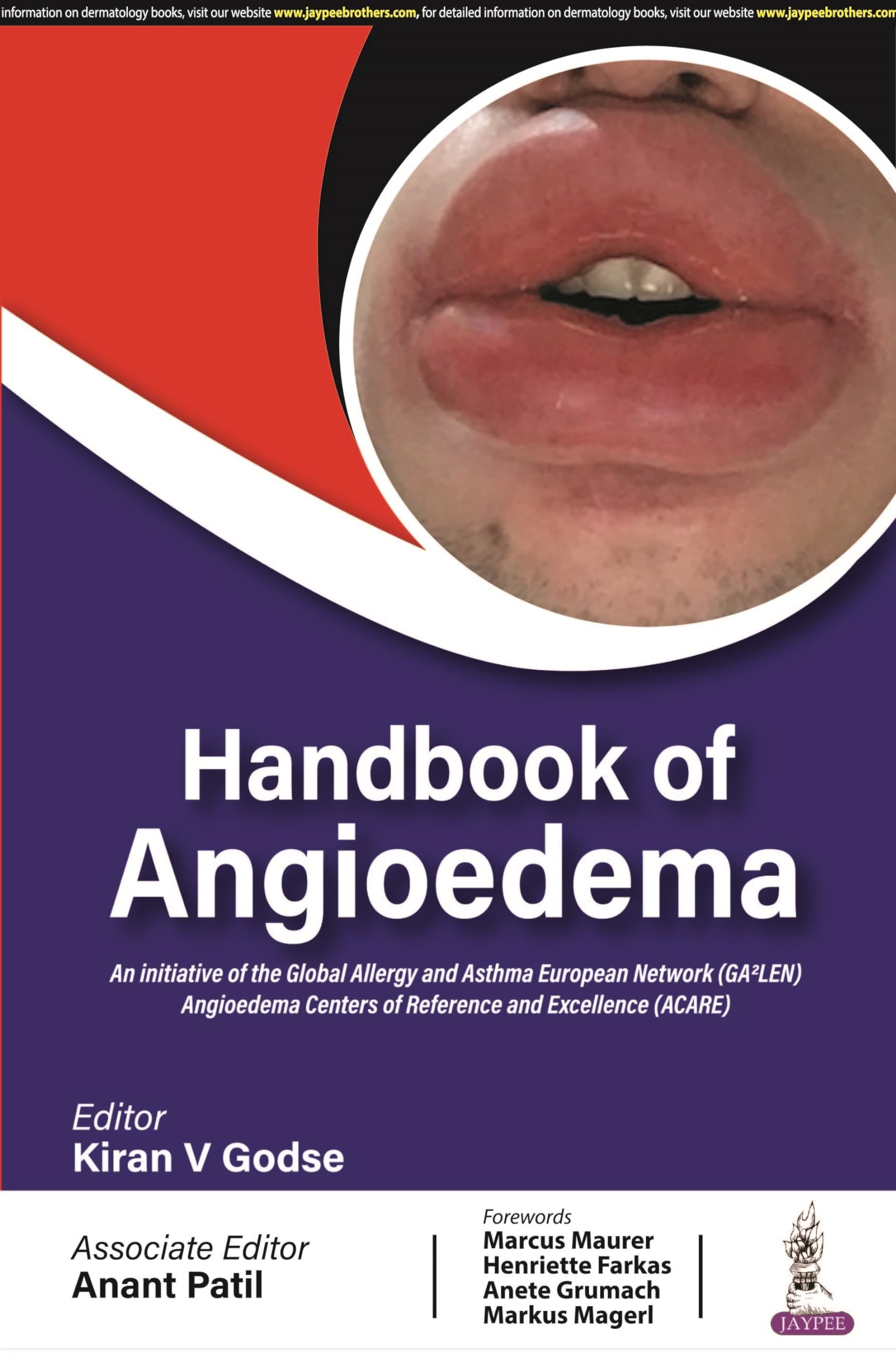 Handbook of Angioedema Medicine