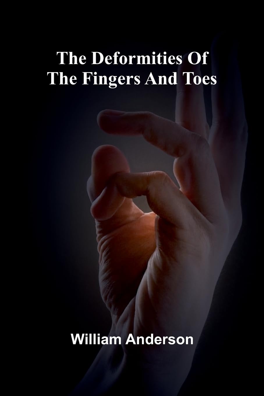 The Deformities Of The Fingers And Toes Medicine