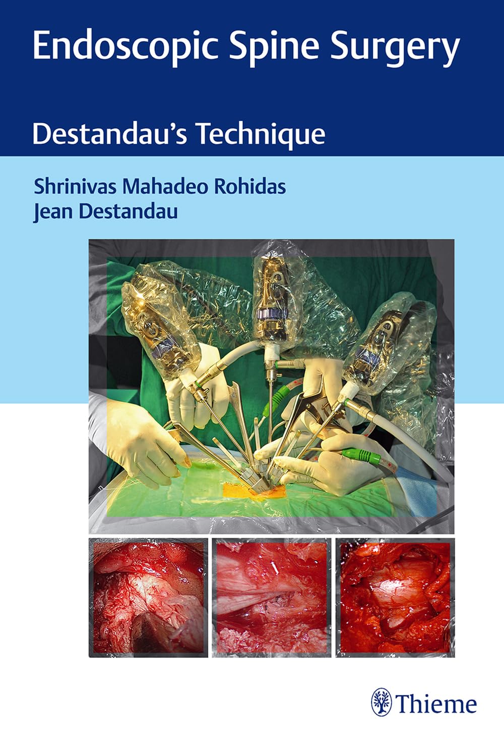 Endoscopic Spine Surgery: Destandau's Technique book