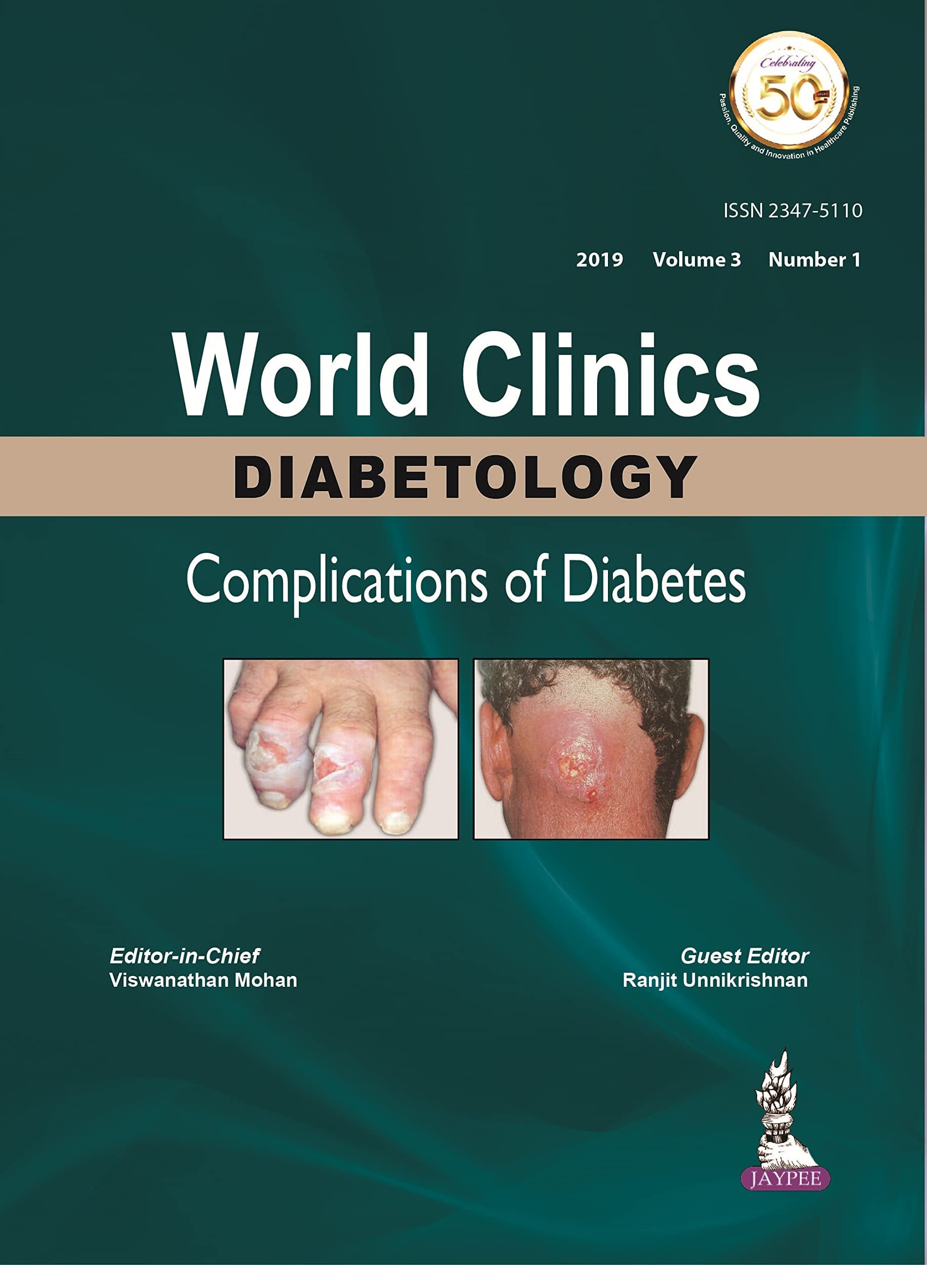 World Clinics Diabetology: Complications of Diabetes: Volume 3, Number 1 book