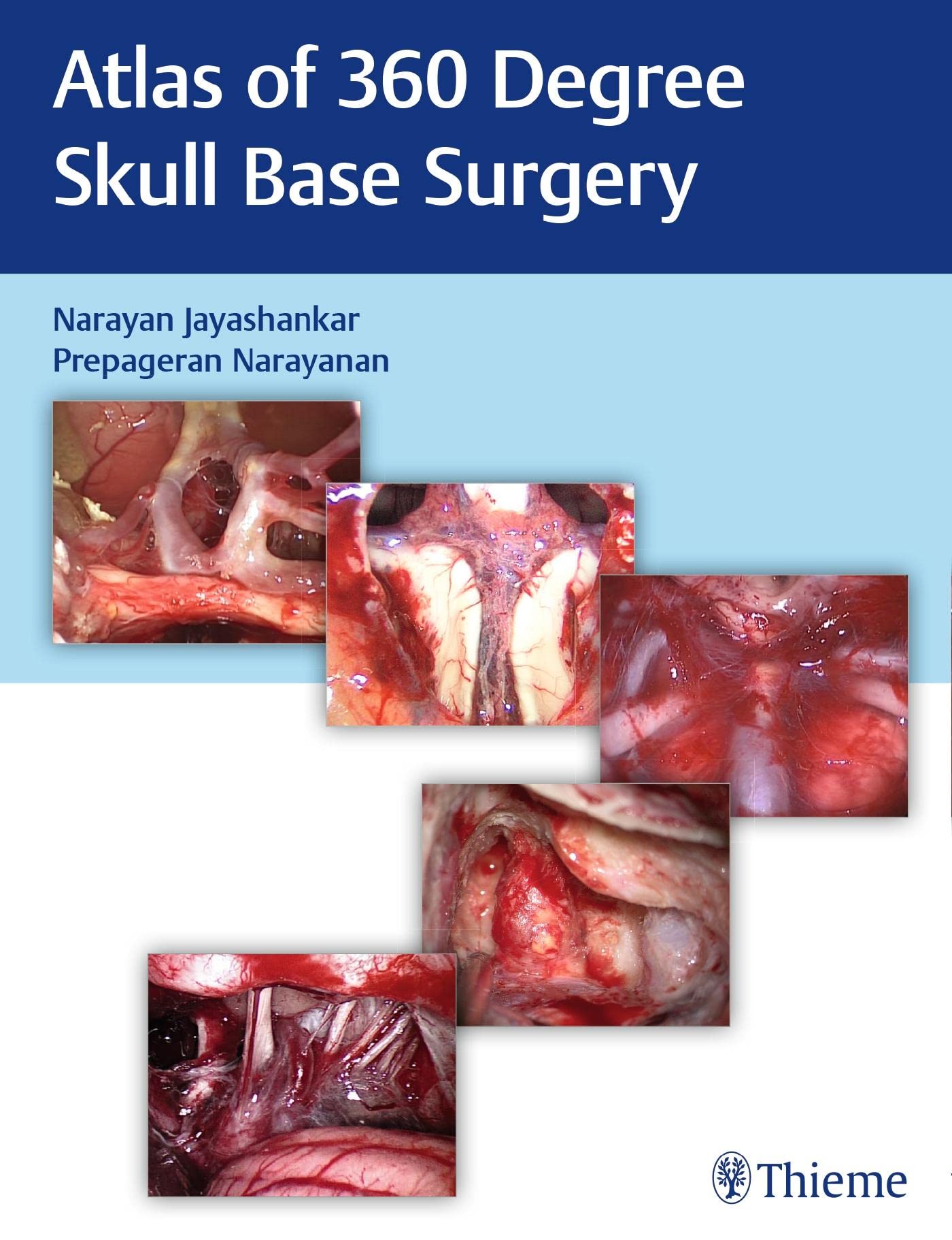 Atlas of 360 Degree Skull Base Surgery Medicine