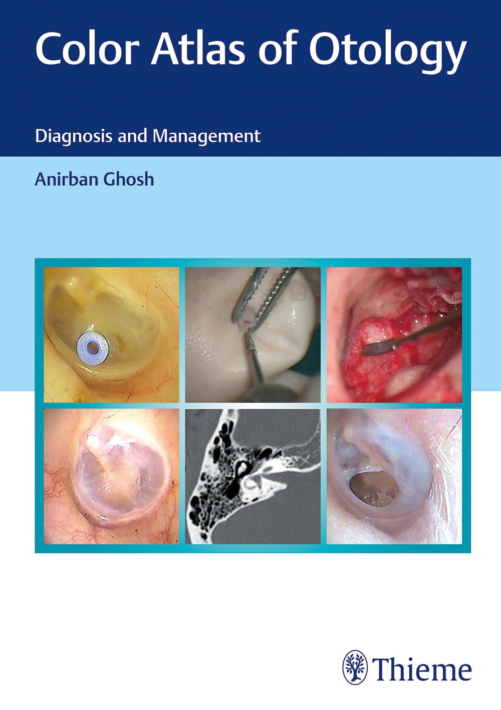 Color Atlas of Otology: Diagnosis and Management Medicine
