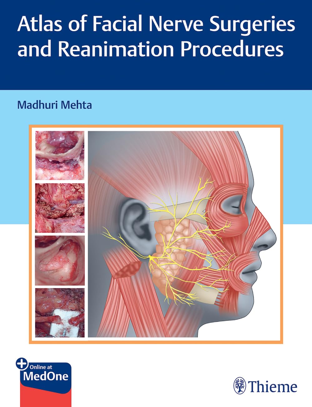 Atlas of Facial Nerve Surgeries and Reanimation Procedures Medicine