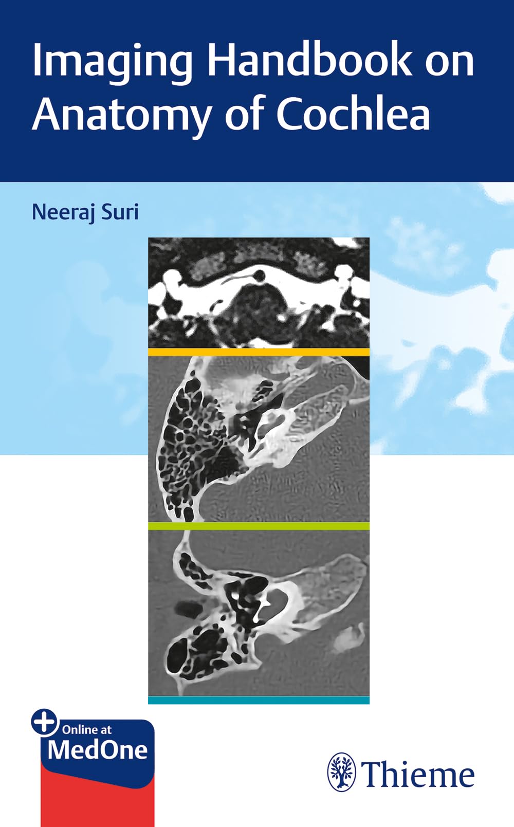 Imaging Handbook on Anatomy of Cochlea Medicine