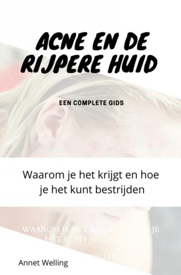 Acne bij volwassenen: Waarom je het krijgt en hoe je het kunt bestrijden Leisure, Home & Garden