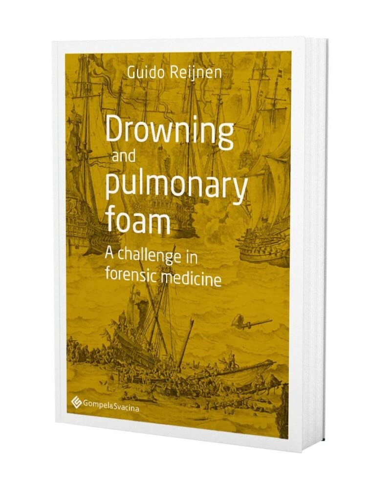 Drowning and pulmonary foam. A challenge in forensic medicine Medicine