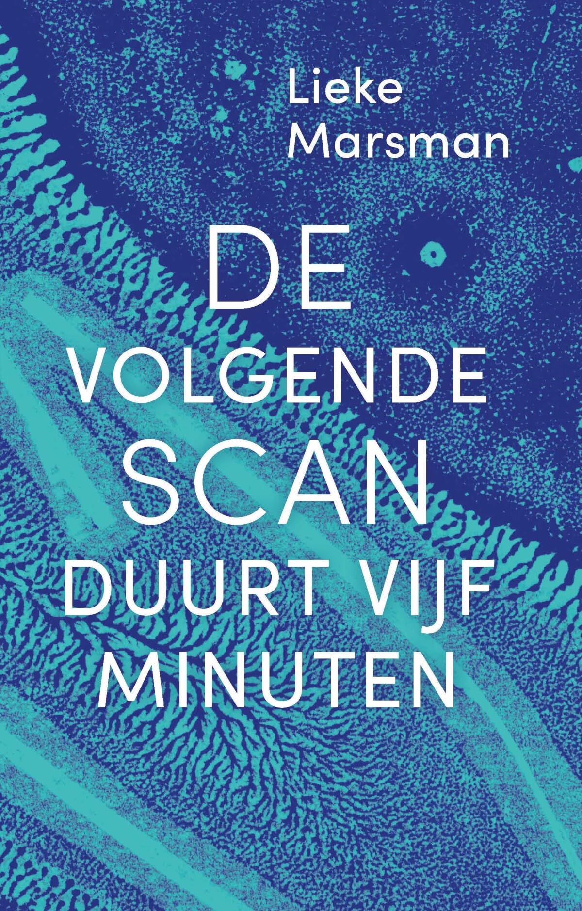 De volgende scan duurt vijf minuten book