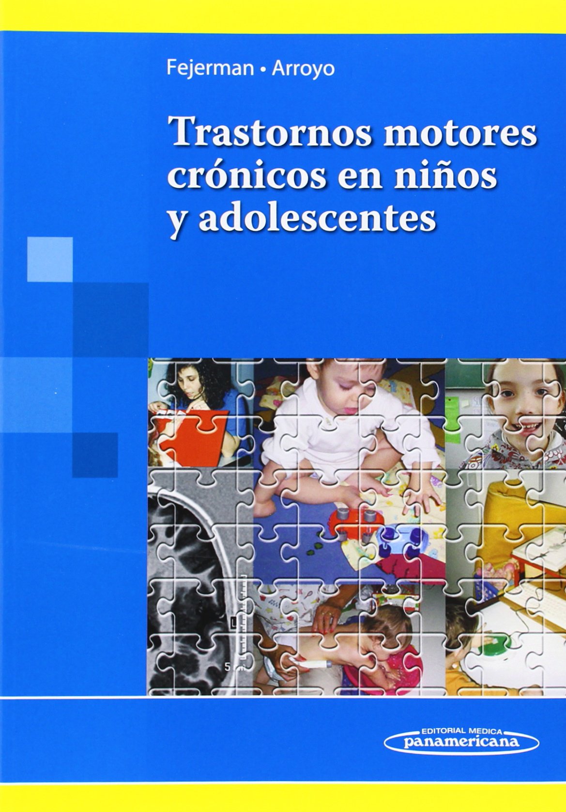 Trastornos motores crónicos en niños y adolescentes Medicine