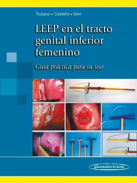 Leep en el Tracto Genital Inferior Femenino. Guía practica para su uso: Guía práctica para su uso Medicine
