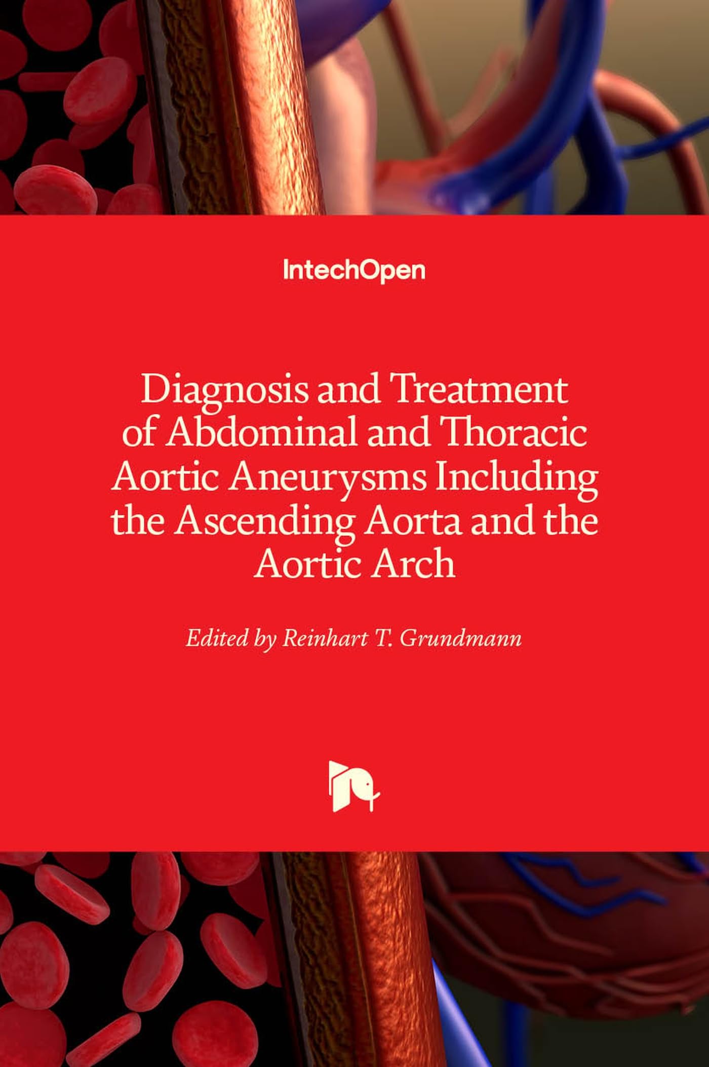 Diagnosis and Treatment of Abdominal and Thoracic Aortic Aneurysms Including the Ascending Aorta and the Aortic Arch Medicine