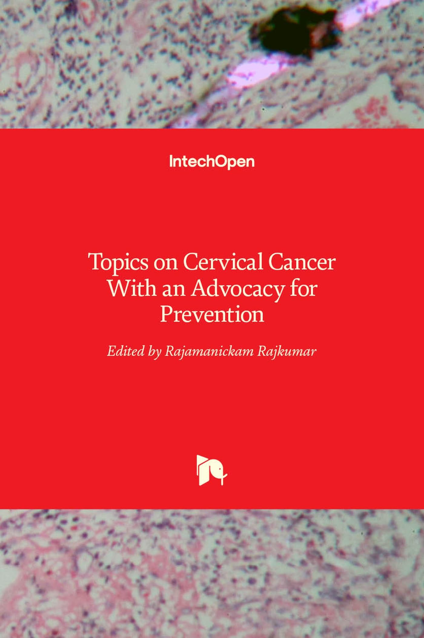 Topics on Cervical Cancer With an Advocacy for Prevention Medicine