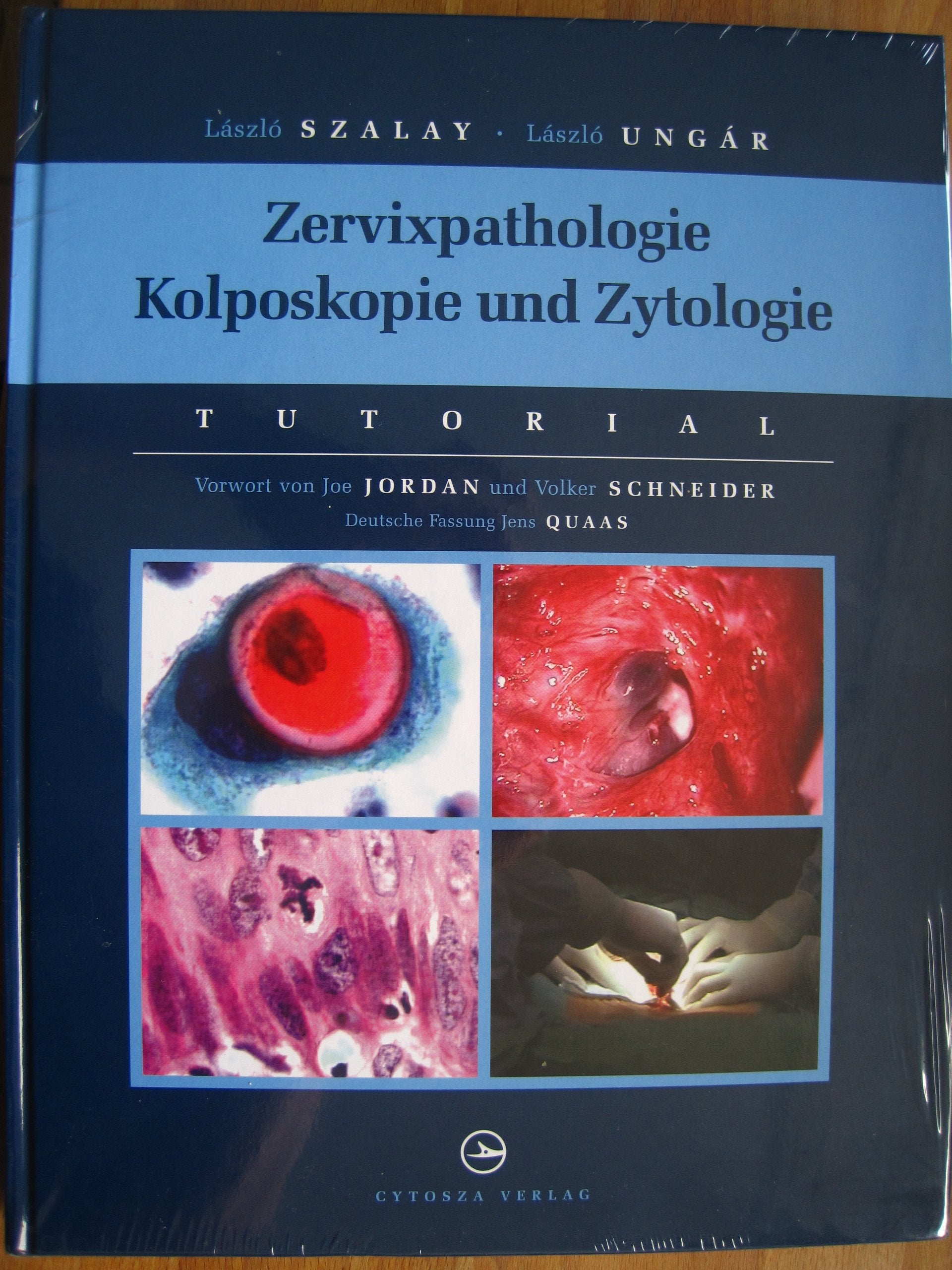 Zervixpathologie Kolposkopie und Zytologie Books
