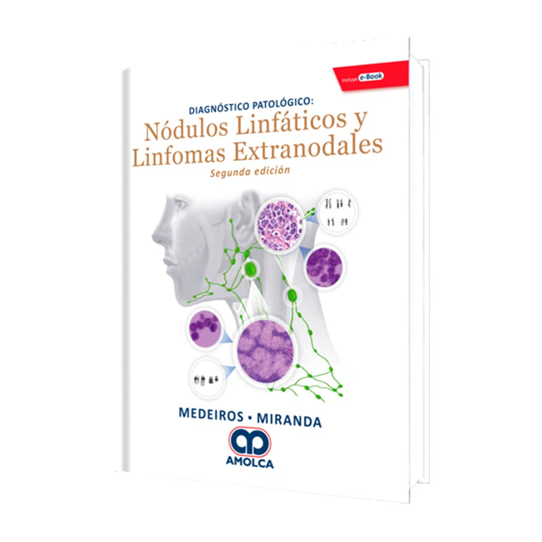 Nódulos Linfáticos y Linfomas Extranodales : Diagnóstico Patológico Books