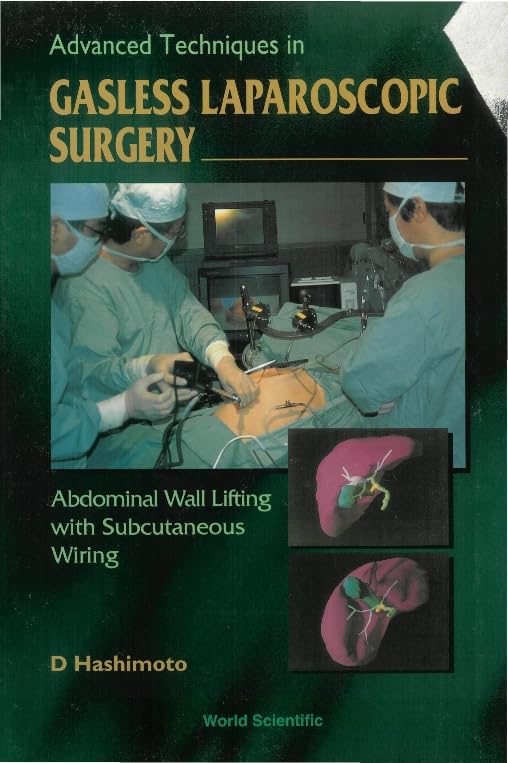Advanced Techniques In Gasless Laparoscopic Surgery: Abdominal Wall Lifting With Subcutaneous Wiring Medicine