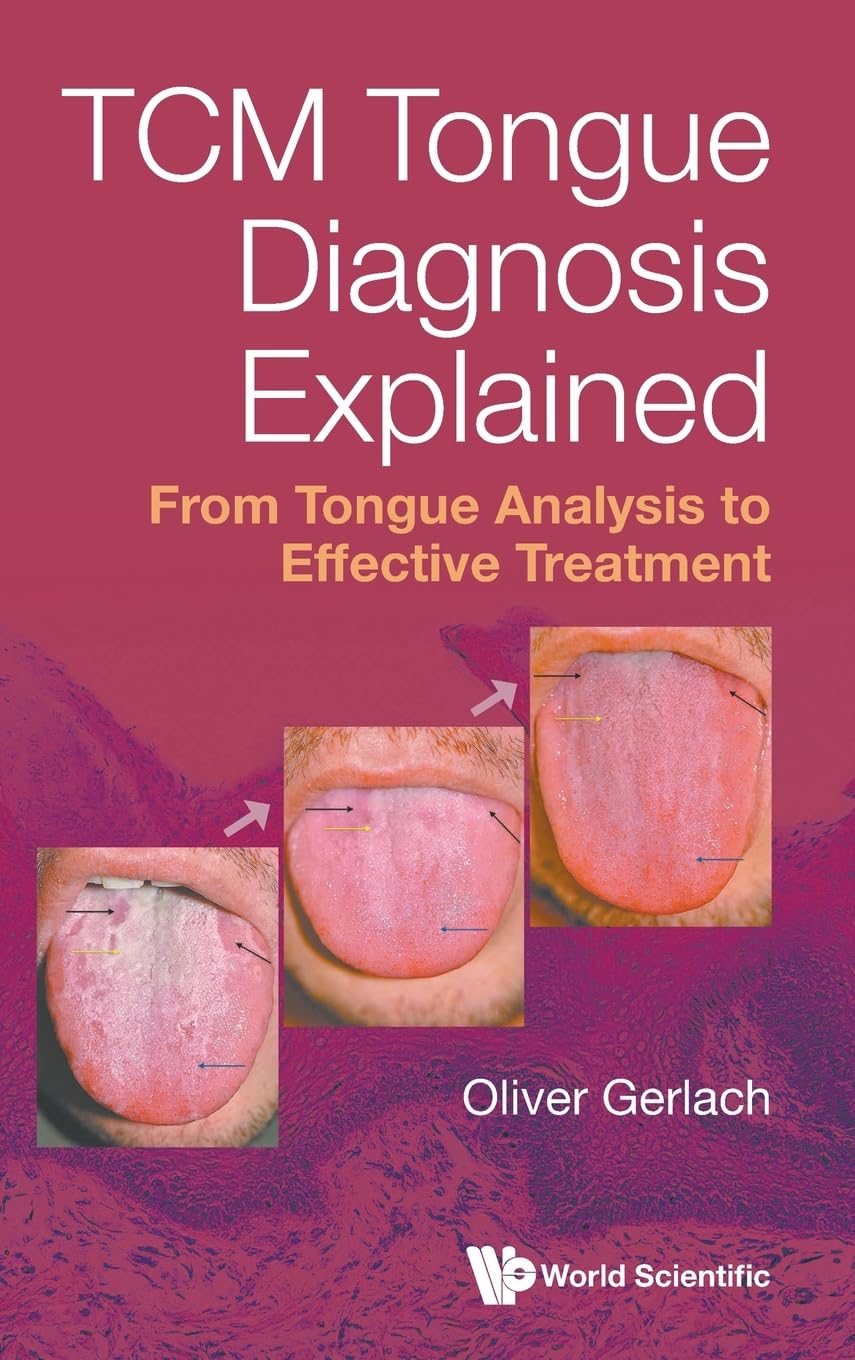 Product Image: TCM TONGUE DIAGNOSIS EXPLAINED