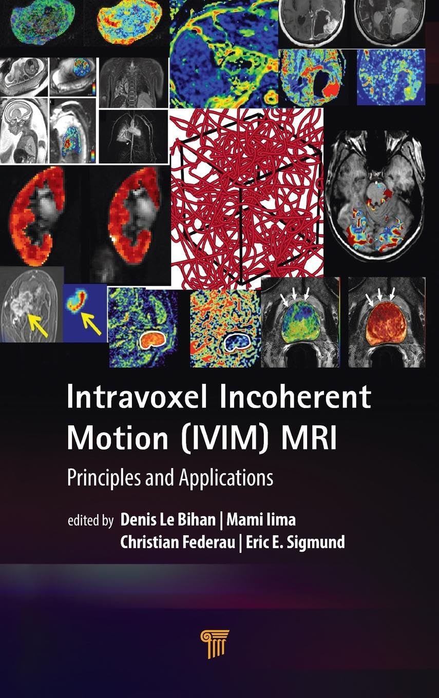 Intravoxel Incoherent Motion (IVIM) MRI Medicine