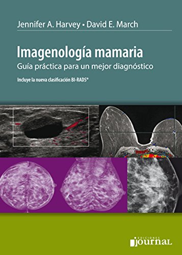 Imagenología Mamaria. Guia práctica para un mejor diagnóstico (Spanish Edition) Books
