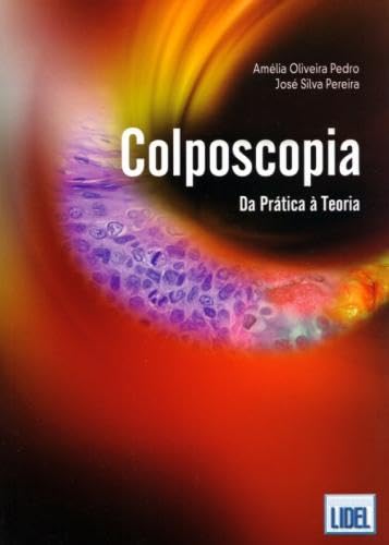 Colposcopia Da prática à teoria (Portuguese Edition) José Silva Pererira e Amélia Oliveira Pedro book