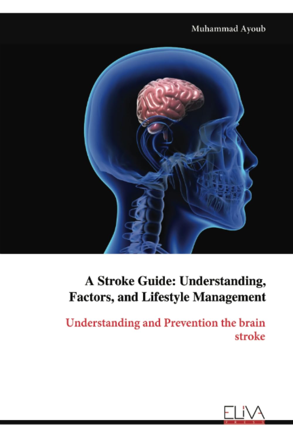 A Stroke Guide Learning & Reference