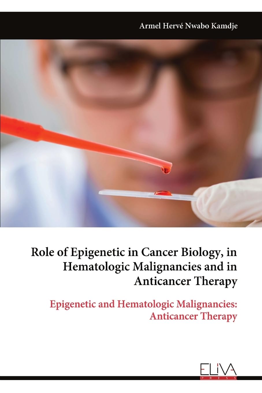 Role of Epigenetic in Cancer Biology, in Hematologic Malignancies and in Anticancer Therapy Medicine