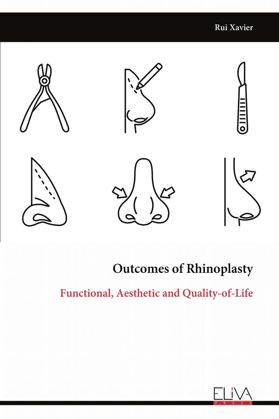 Outcomes of Rhinoplasty Medicine