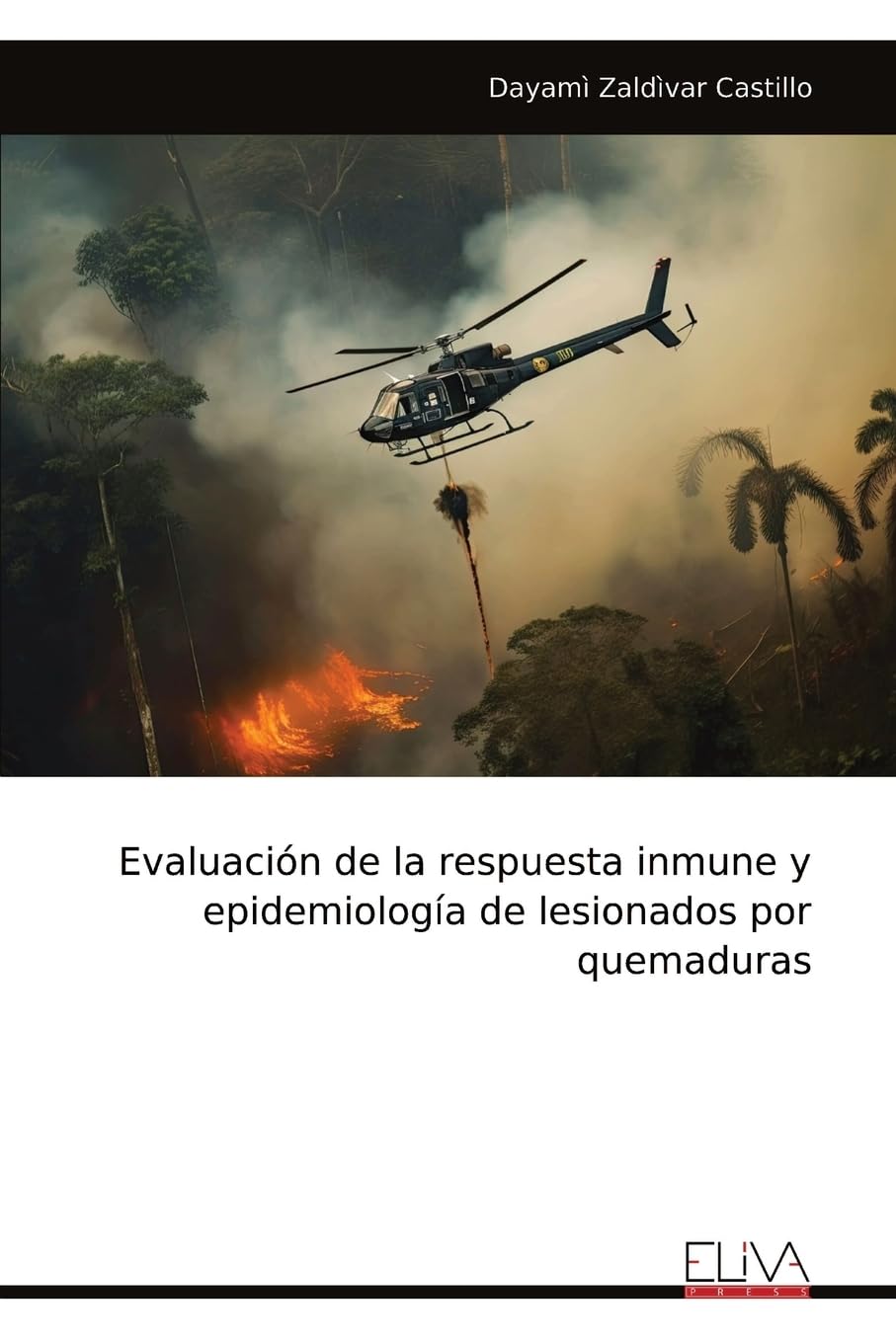 Evaluación de la respuesta inmune y epidemiología de lesionados por quemaduras Medicine