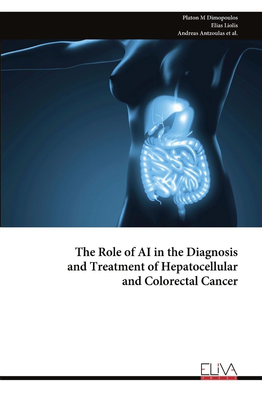 The Role of AI in the Diagnosis and Treatment of Hepatocellular and Colorectal Cancer Medicine