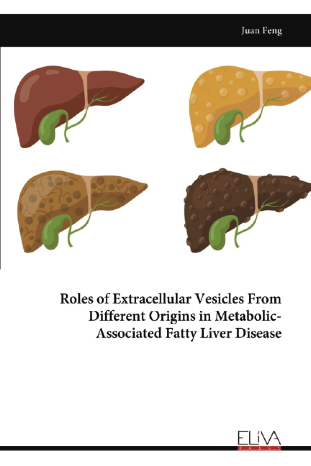 Roles of Extracellular Vesicles From Different Origins in Metabolic- Associated Fatty Liver Disease Medicine