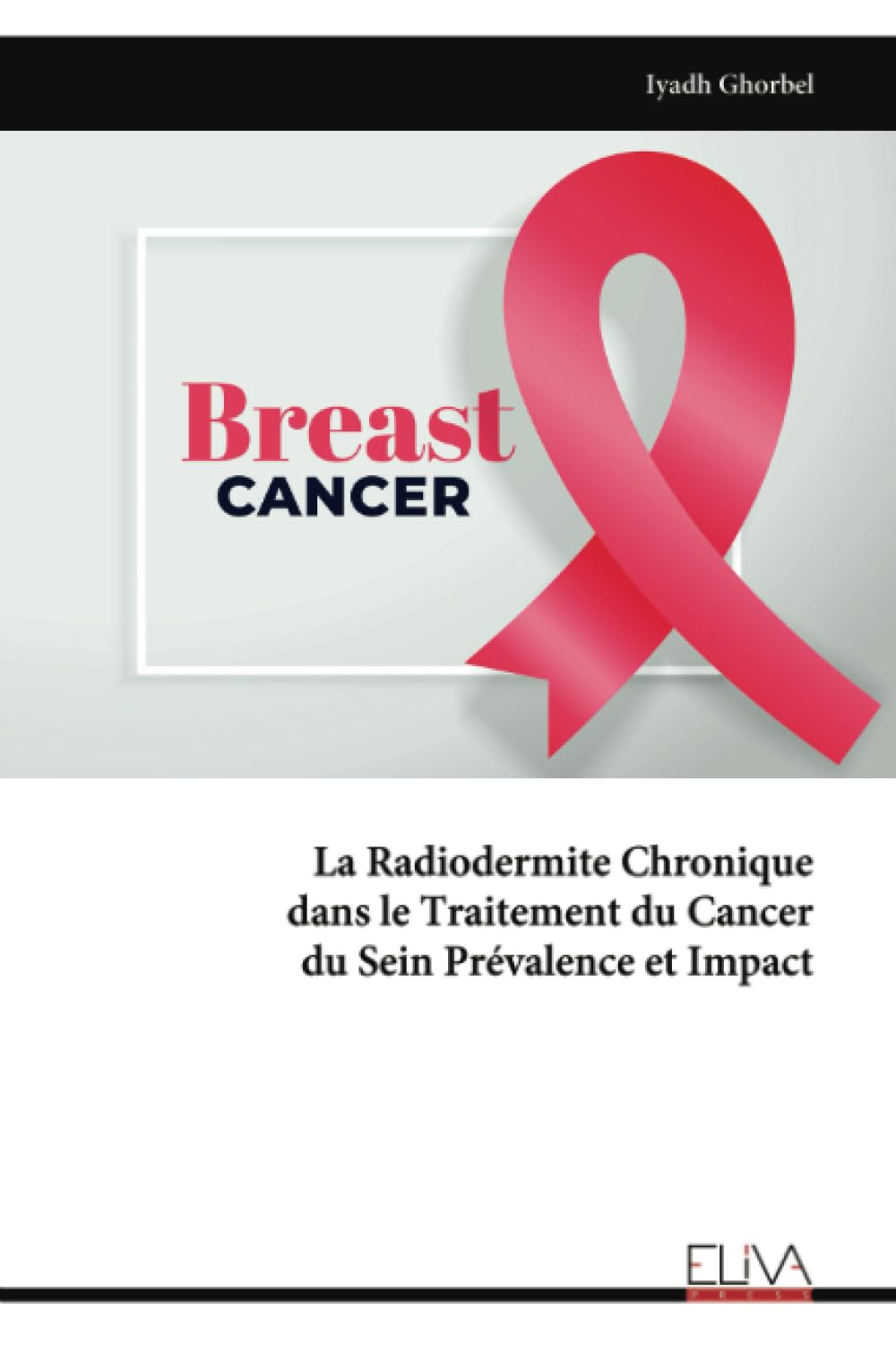 La Radiodermite Chronique dans le Traitement du Cancer du Sein Prévalence et Impact Medicine