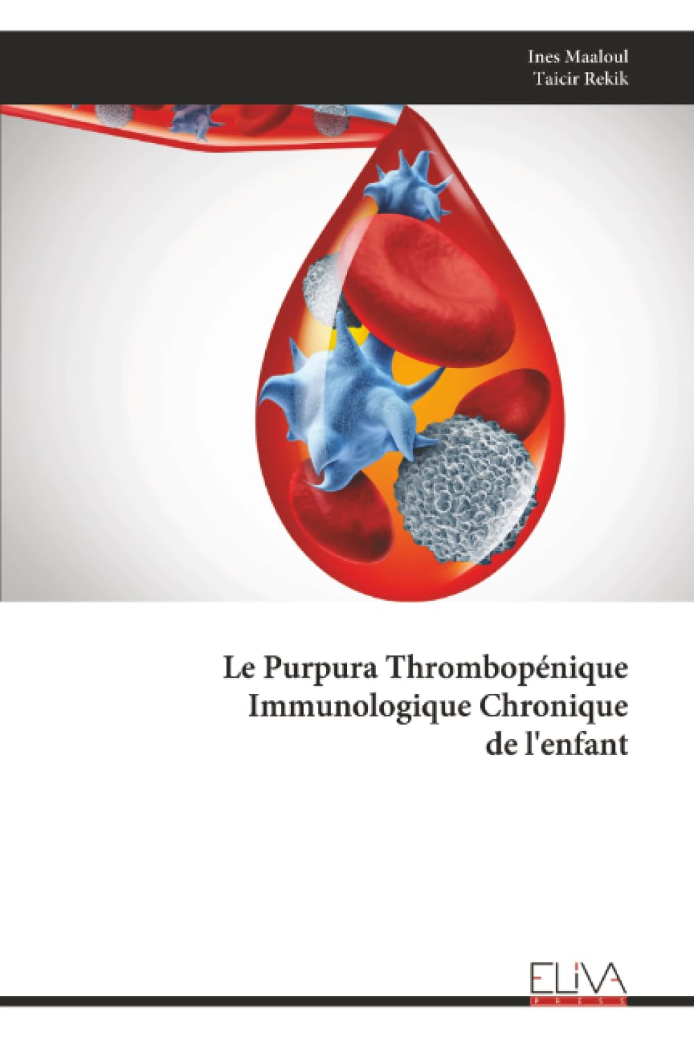 Le Purpura Thrombopénique Immunologique Chronique de l'enfant Medicine