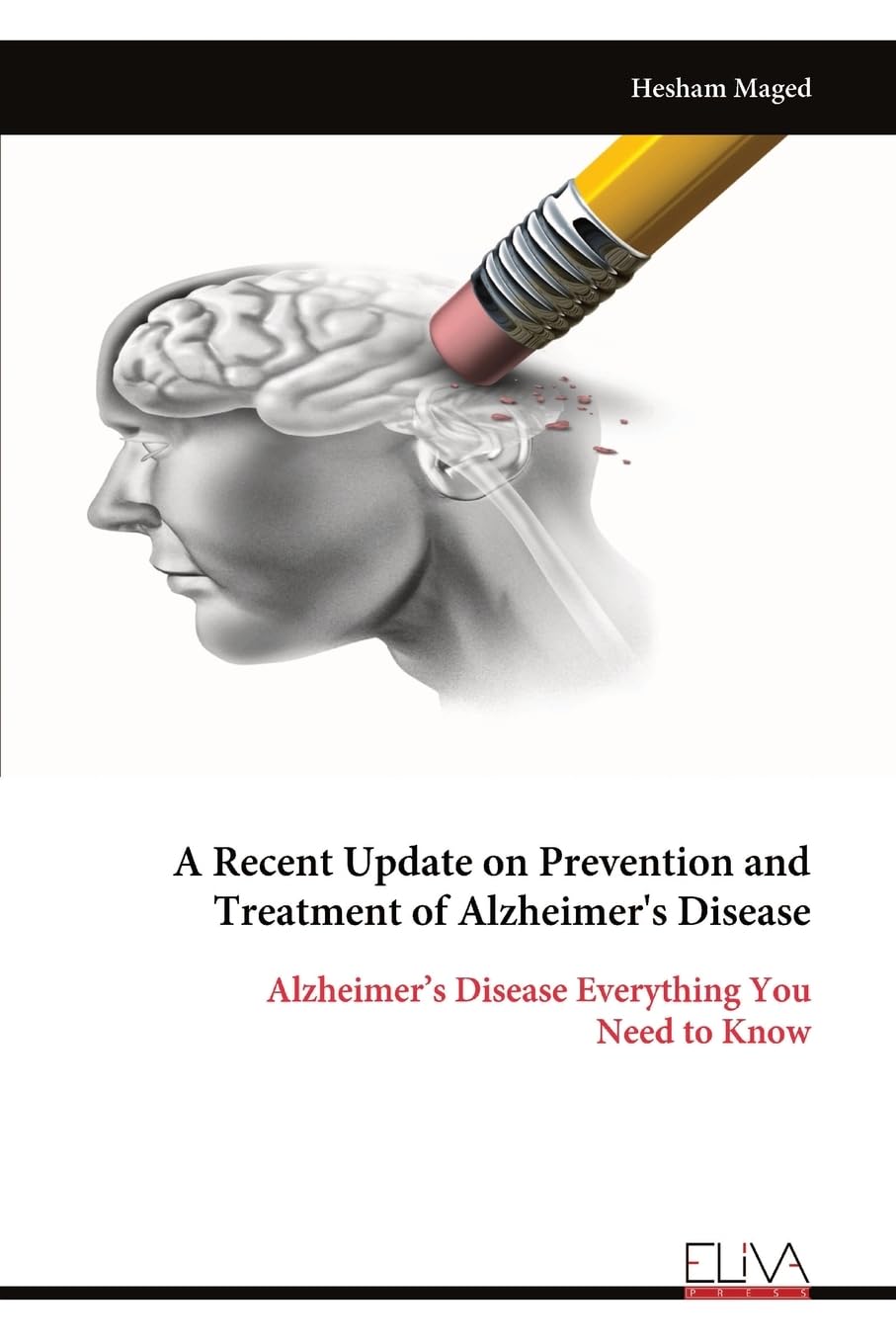 A Recent Update on Prevention and Treatment of Alzheimer's Disease Medicine