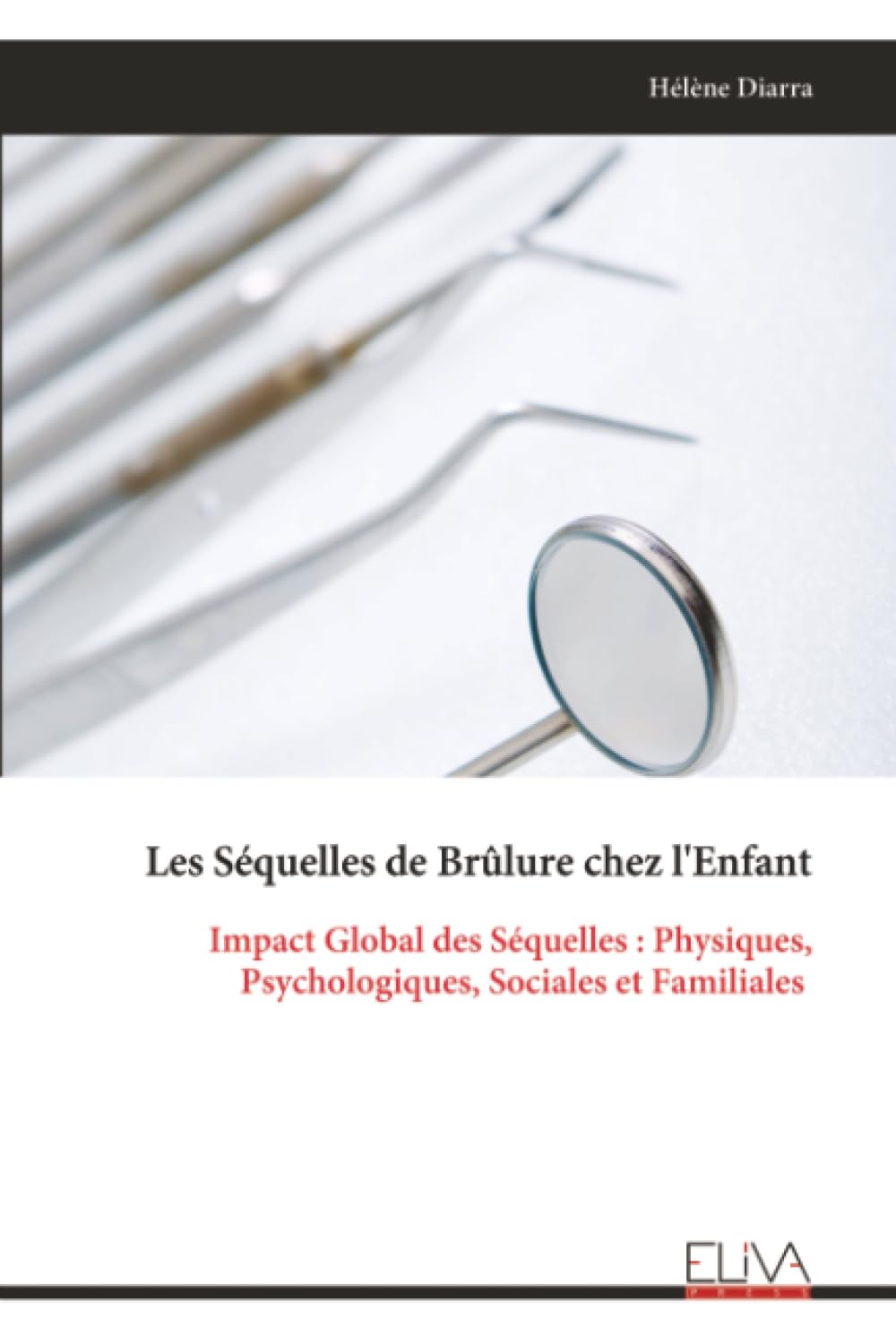 Les Séquelles de Brûlure chez l'Enfant Medicine