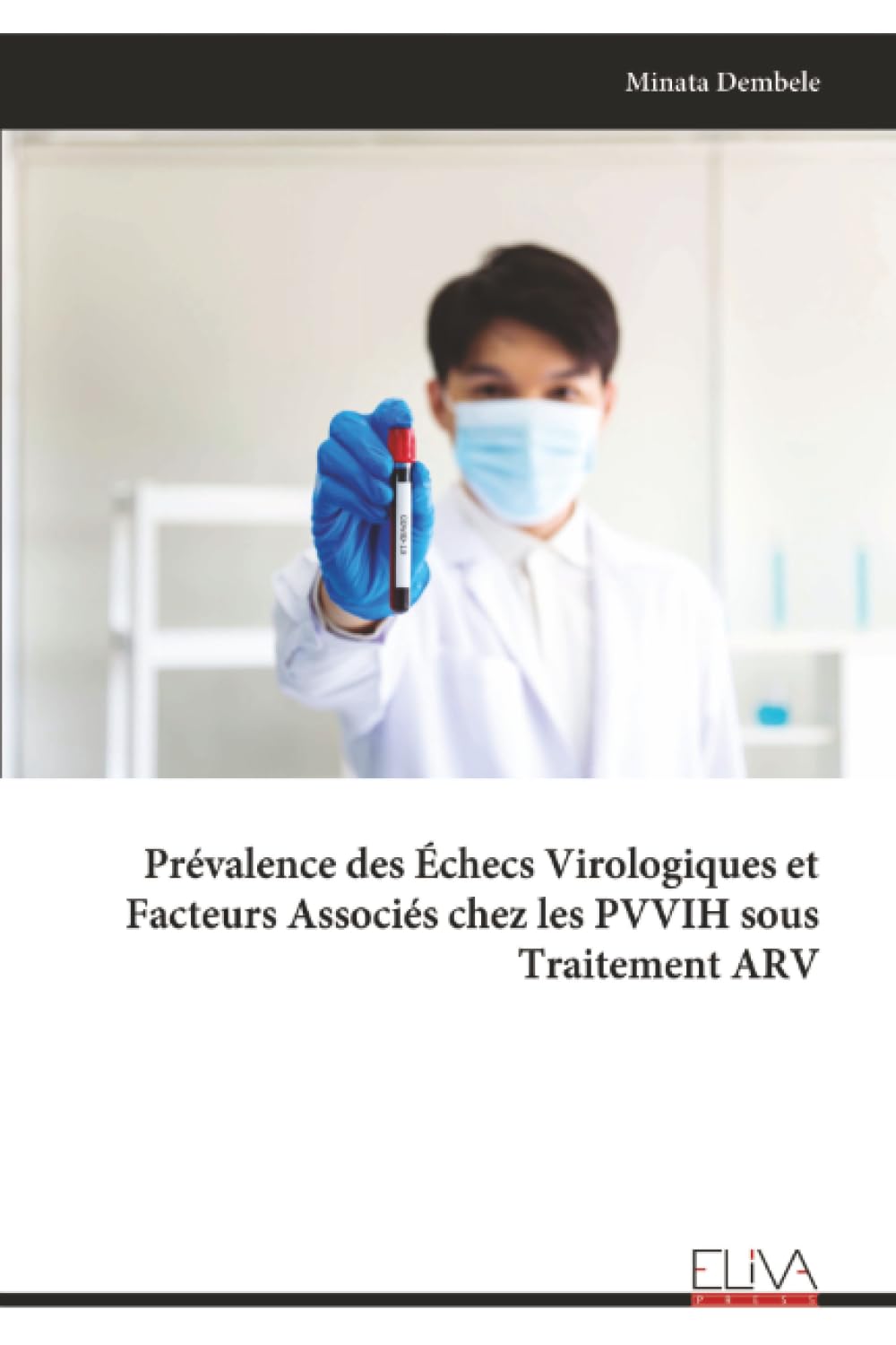 Prévalence des Échecs Virologiques et Facteurs Associés chez les PVVIH sous Traitement ARV Medicine