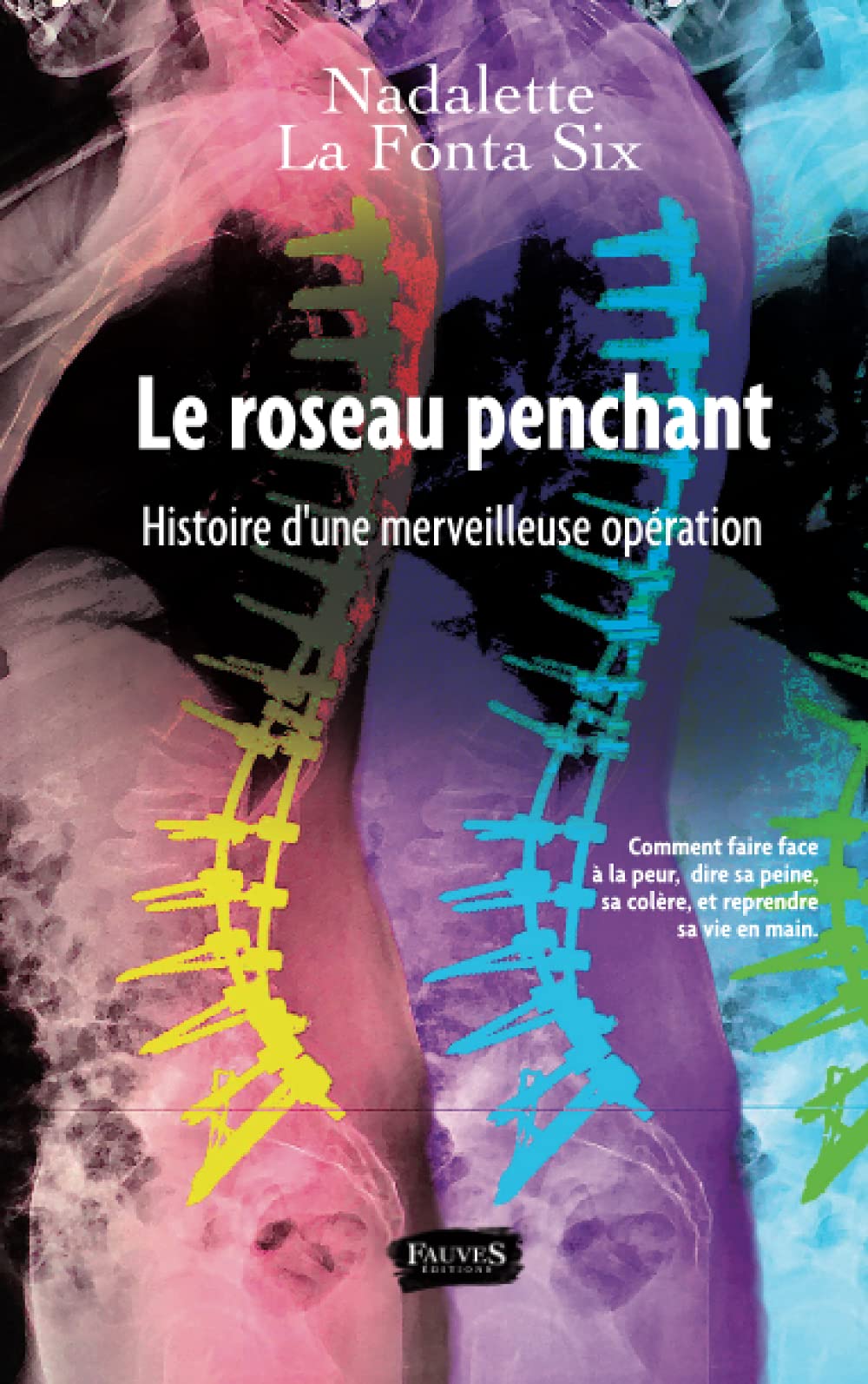 Le Roseau penchant: Histoire d'une merveilleuse opération Contemporary literature