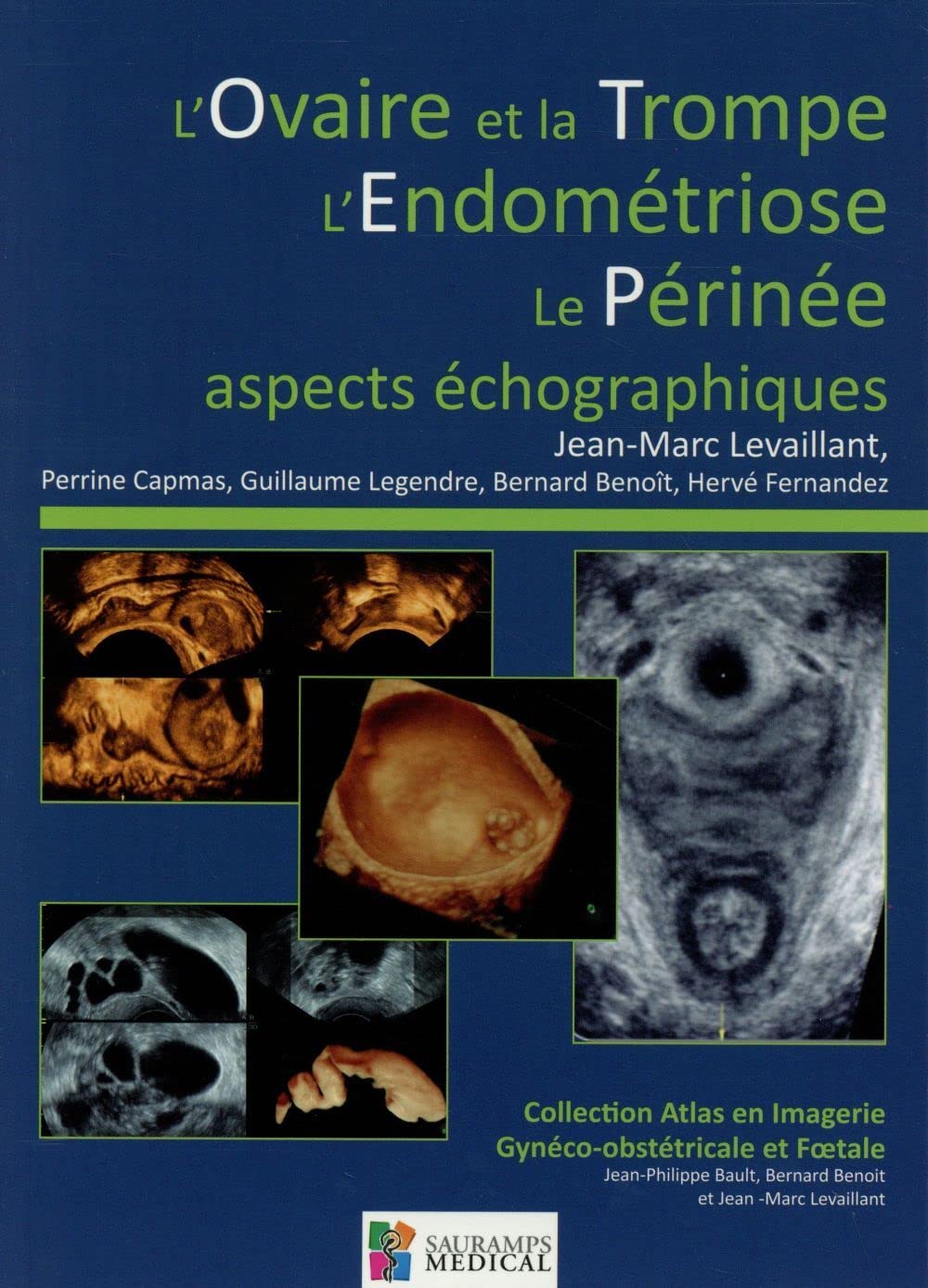 L OVAIRE ET LA TROMPE-L ENDOMETRIOSE-LE PERINEE-ASPECTS ECHOGRAPHIQUES: Aspects échographiques Medicine
