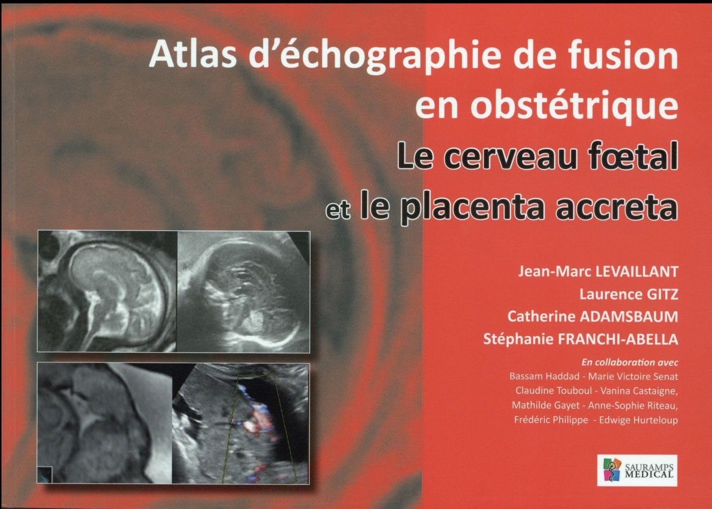 LE CERVEAU FOETAL ET LE PLACENTA ACCRETA. ATLAS D ECHOGRAPHIE DE FUSION EN GYNEC book