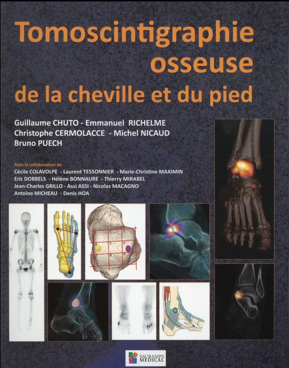 TOMOSCINTIGRAPHIE OSSEUSE DE LA CHEVILLE ET DU PIED book